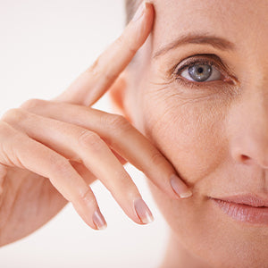 What Causes Crow's Feet & Under Eye Wrinkles?