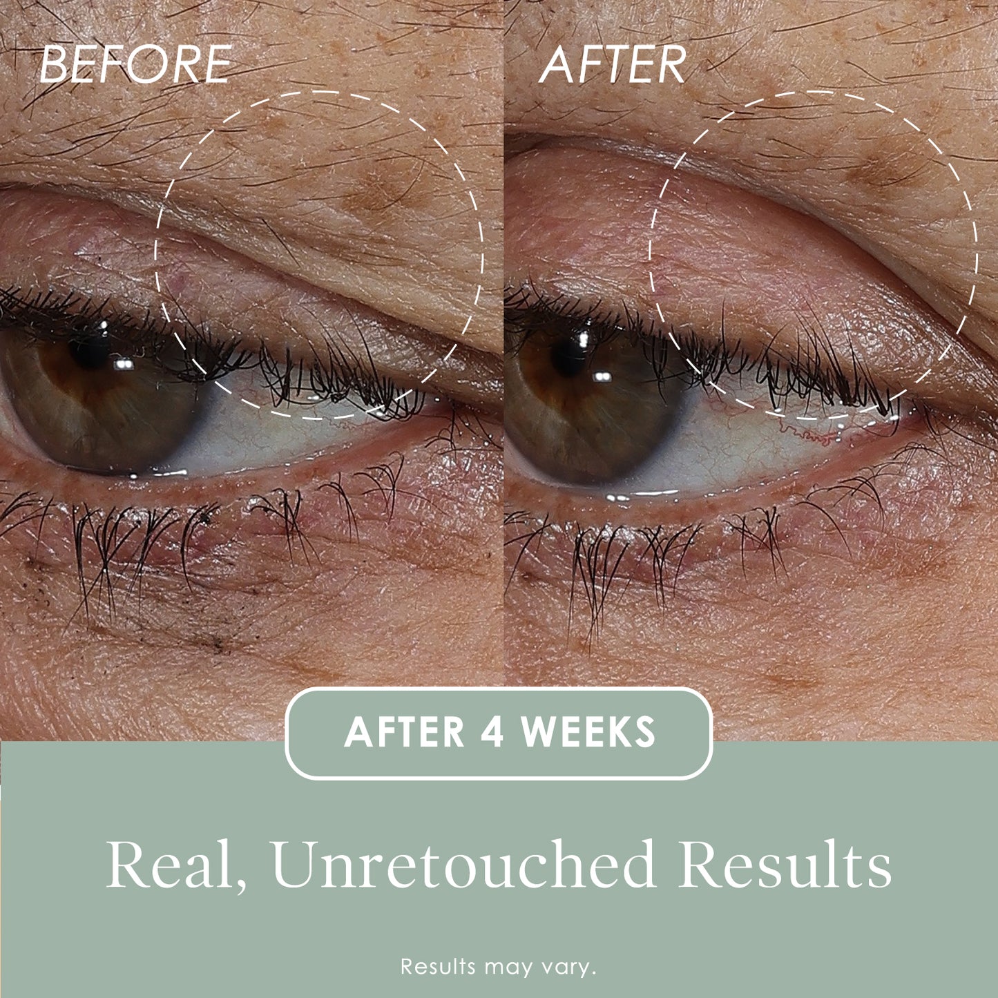 Lift & Smooth Eyelid Treatment